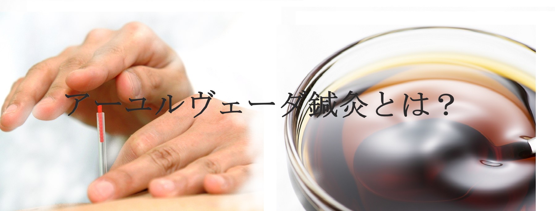 鍼×オイル